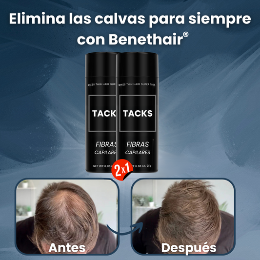 Acaba con tu complejo para siempre con BenetHair®